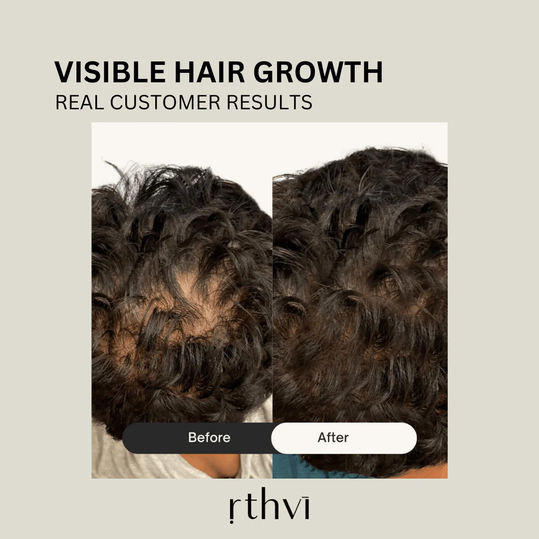 Revitalize Natural Hair Growth Oil