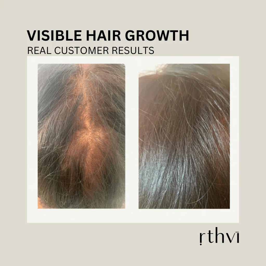 Restore Hair Thickening Serum