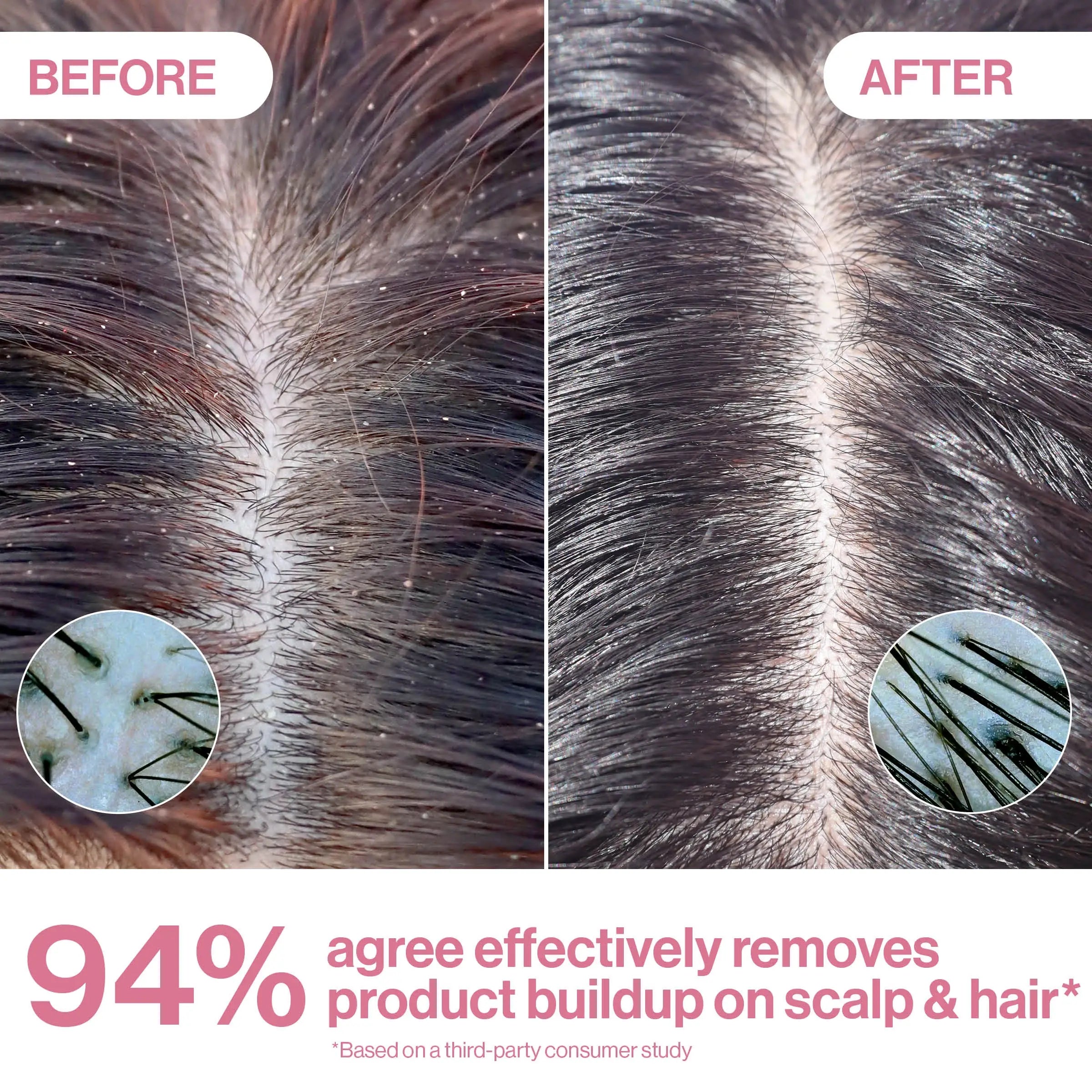 Apple Cider Vinegar Scalp & Hair Rinse