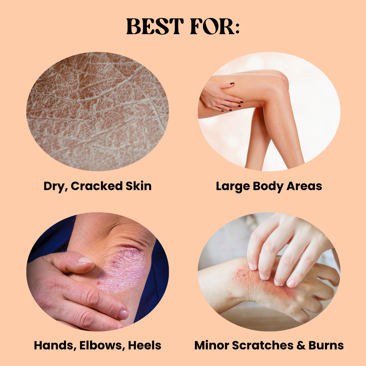 Moisturizing Body Lotion