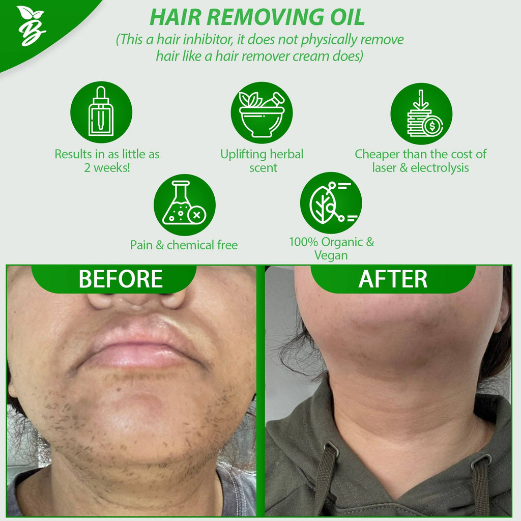 Bye Bye Hair Removal Oil – Organic Herbal Formula for Chin & Body Hair