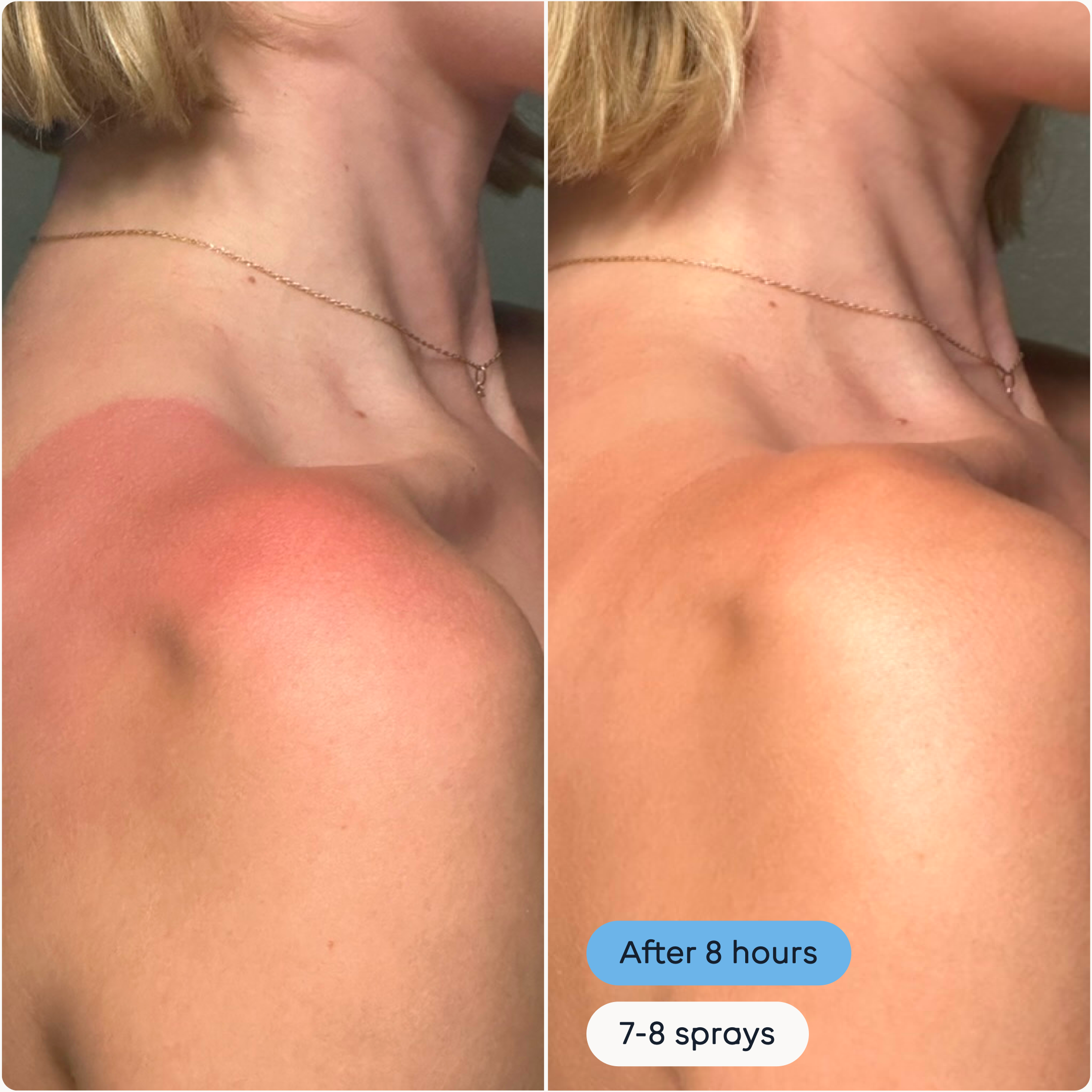 Hypochlorous Acid Antimicrobial Skin Spray
