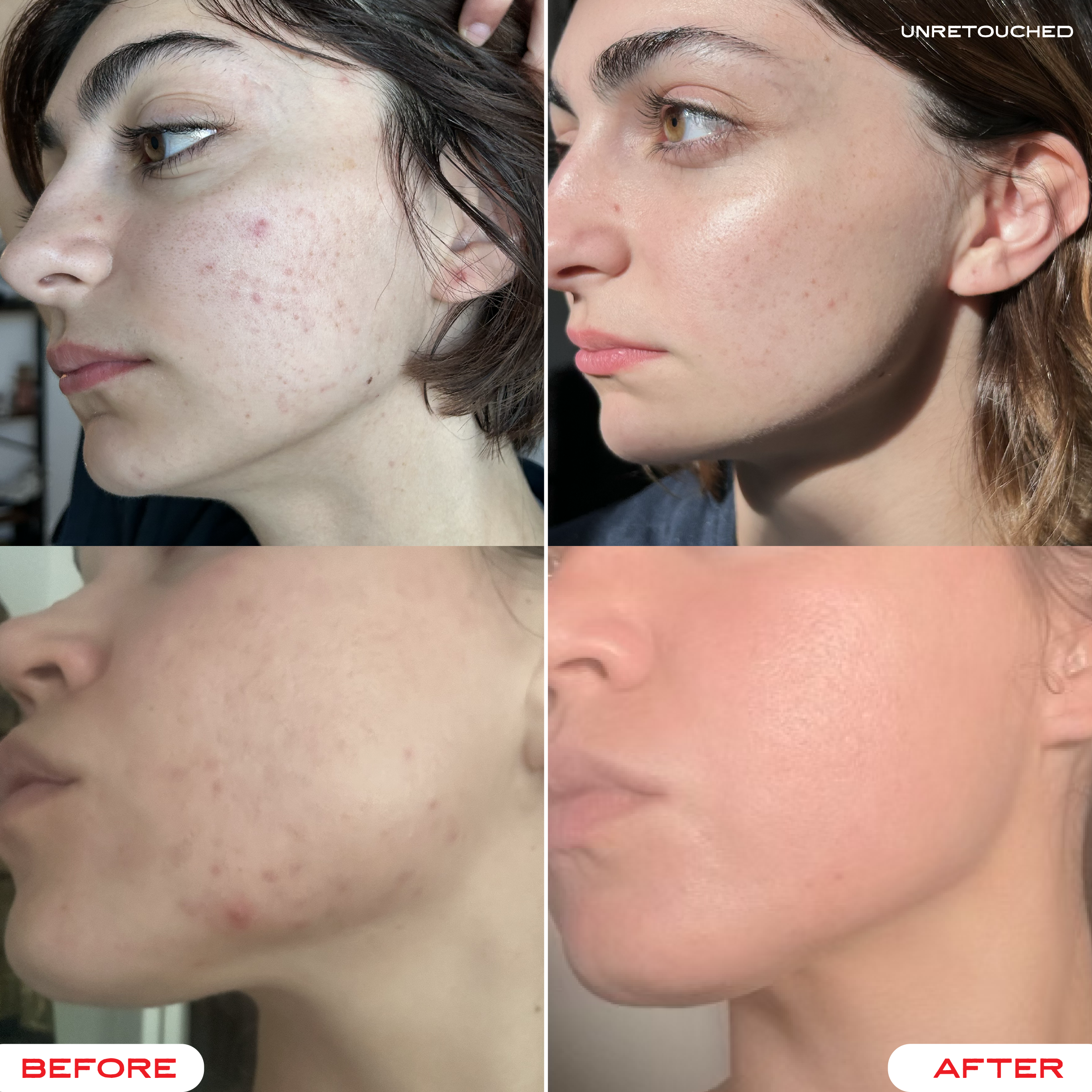 Tallow & Tansy Face Balm | Natural Tallow Skin Care