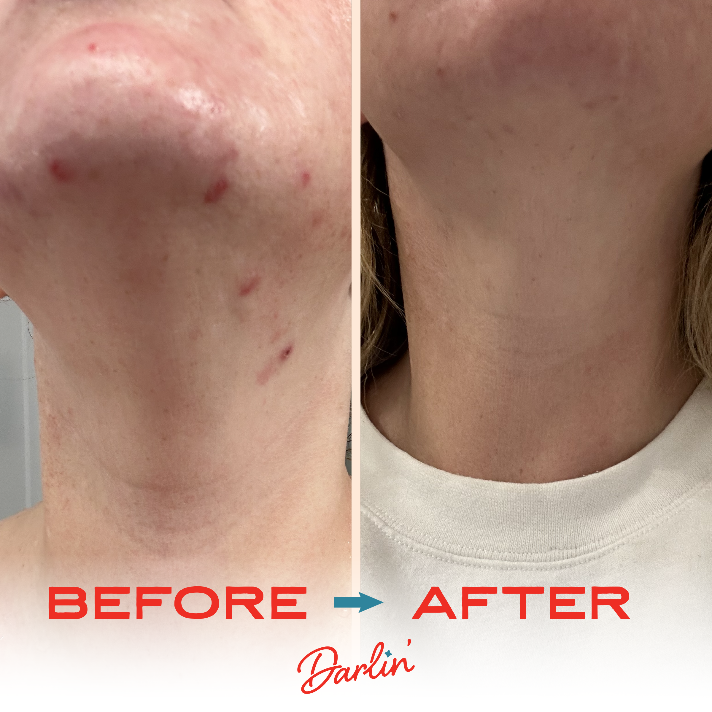 Tallow & Tansy Face Balm | Natural Tallow Skin Care