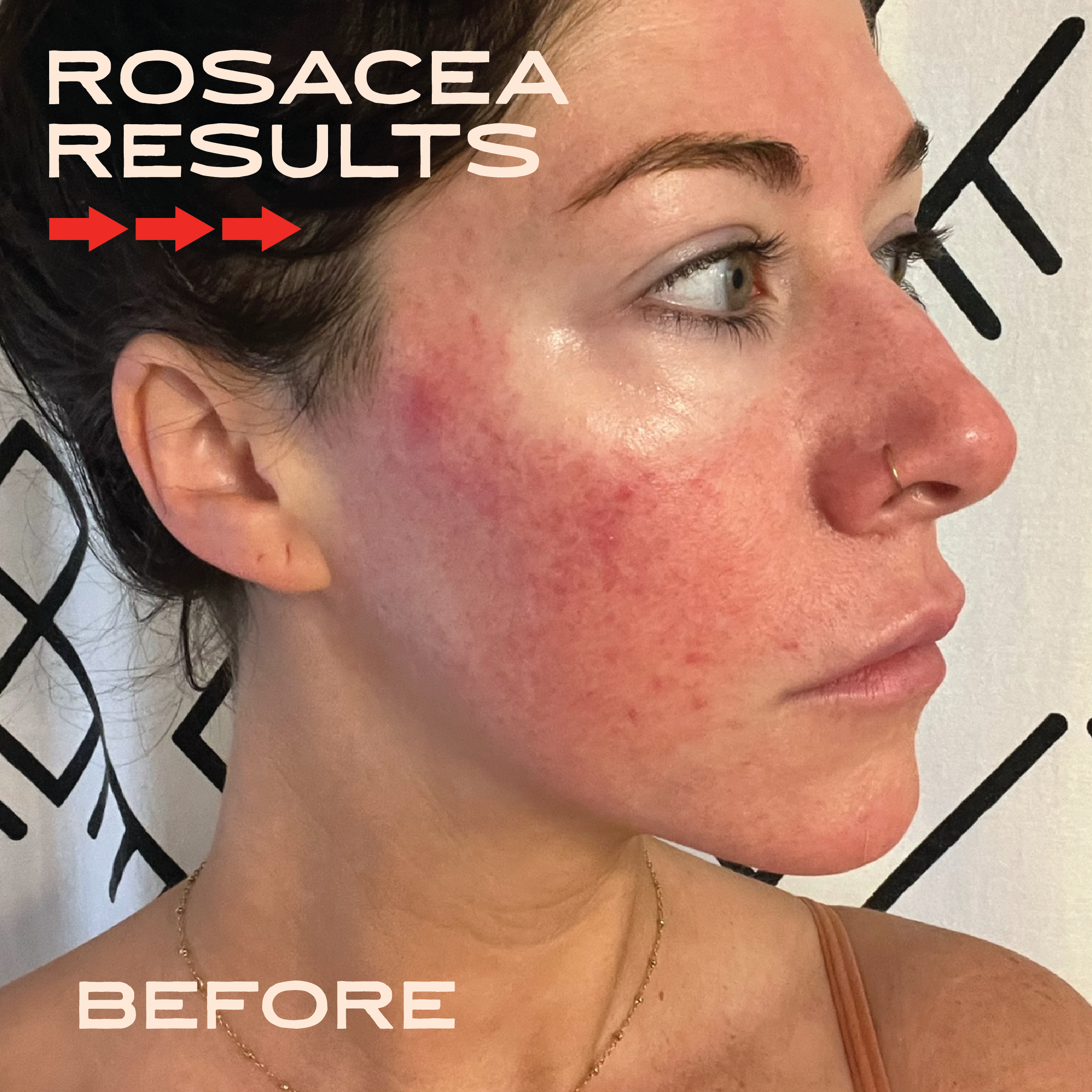 Tallow & Tansy Face Balm | Natural Tallow Skin Care