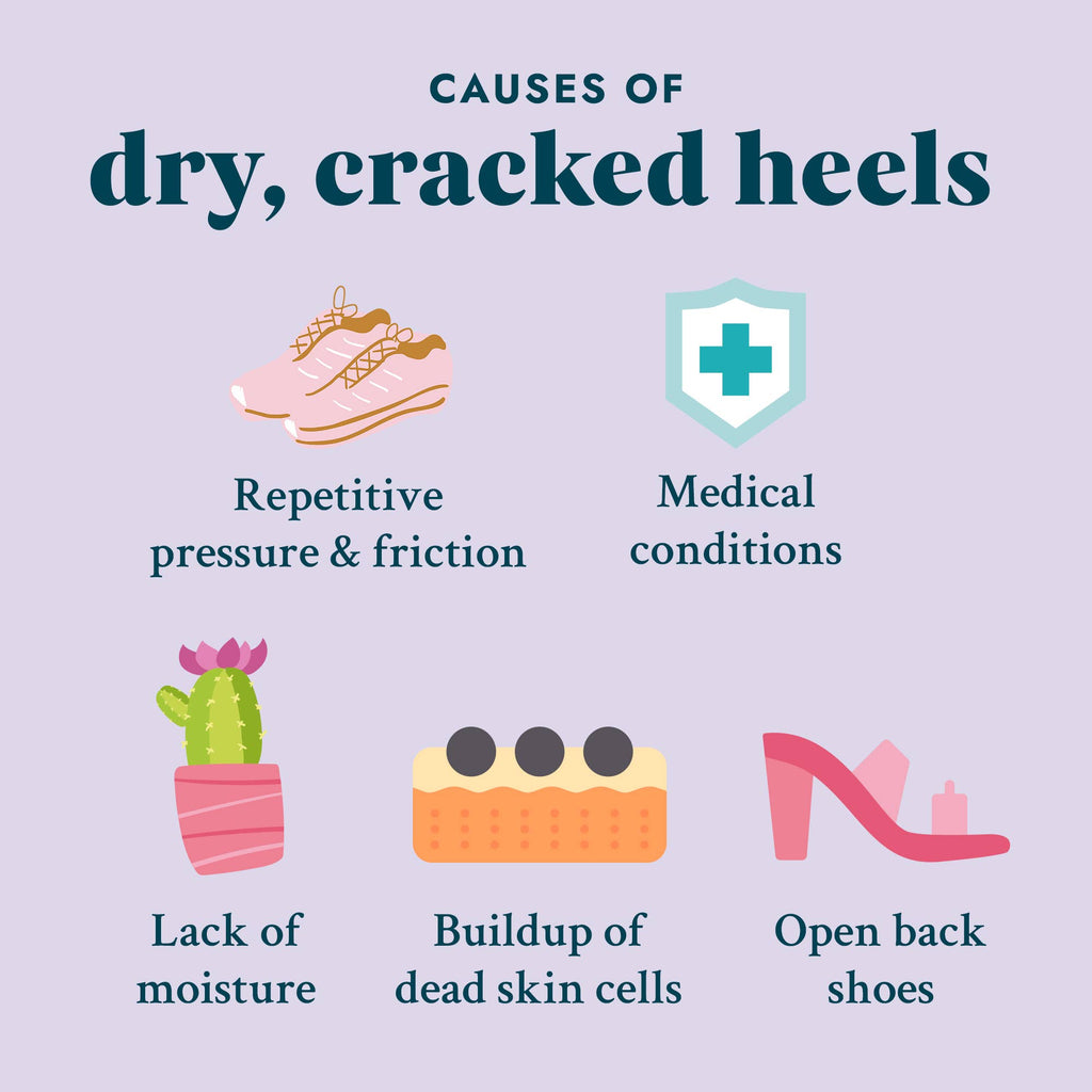 Solemate Heel Repair Balm